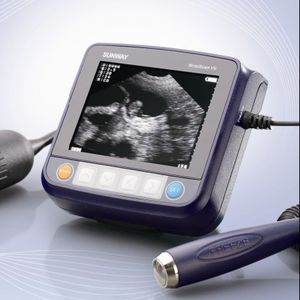 ���������� ������������ ������� Handscan V5 ��� ������� ��������